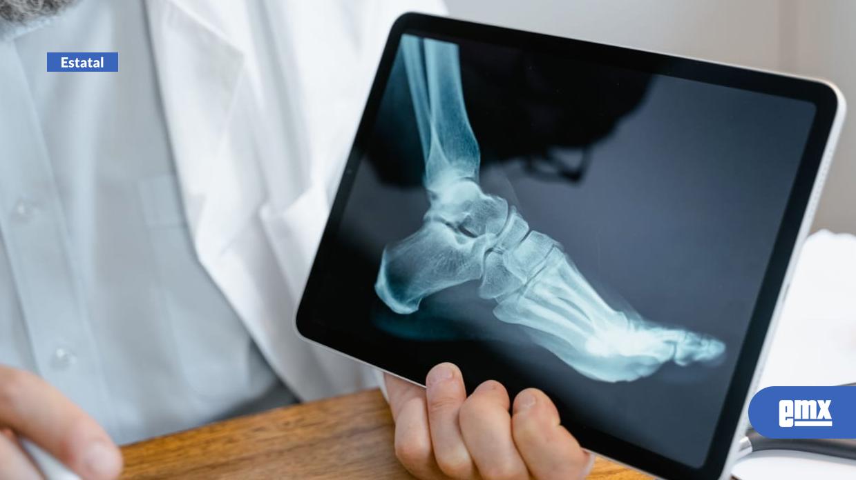 EMX-Llaman-a-prevenir-la-osteoporosis-mediante-hábitos-saludables-y-detección-oportuna