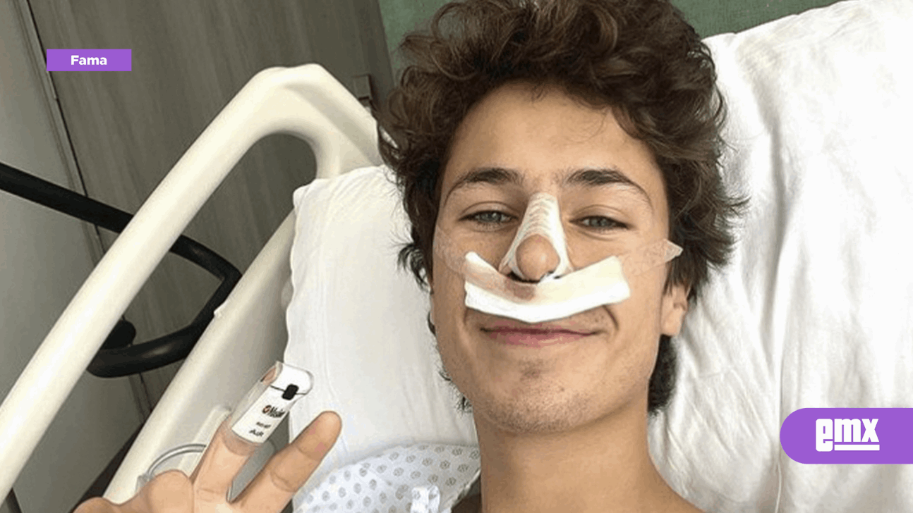 EMX-Juanpa Zurita se somete a cirugía de nariz