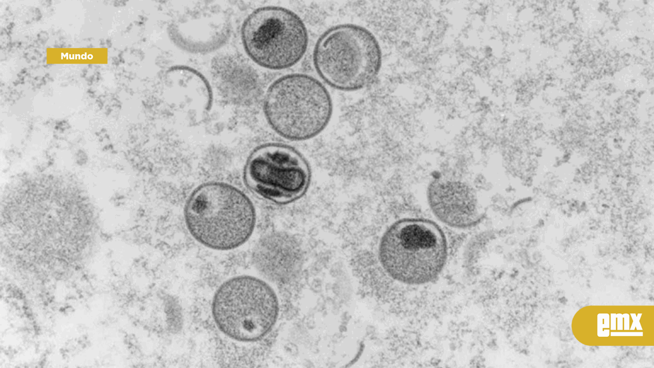 EMX-Patógeno de viruela del mono ha mutado sorprendentemente, alerta estudio