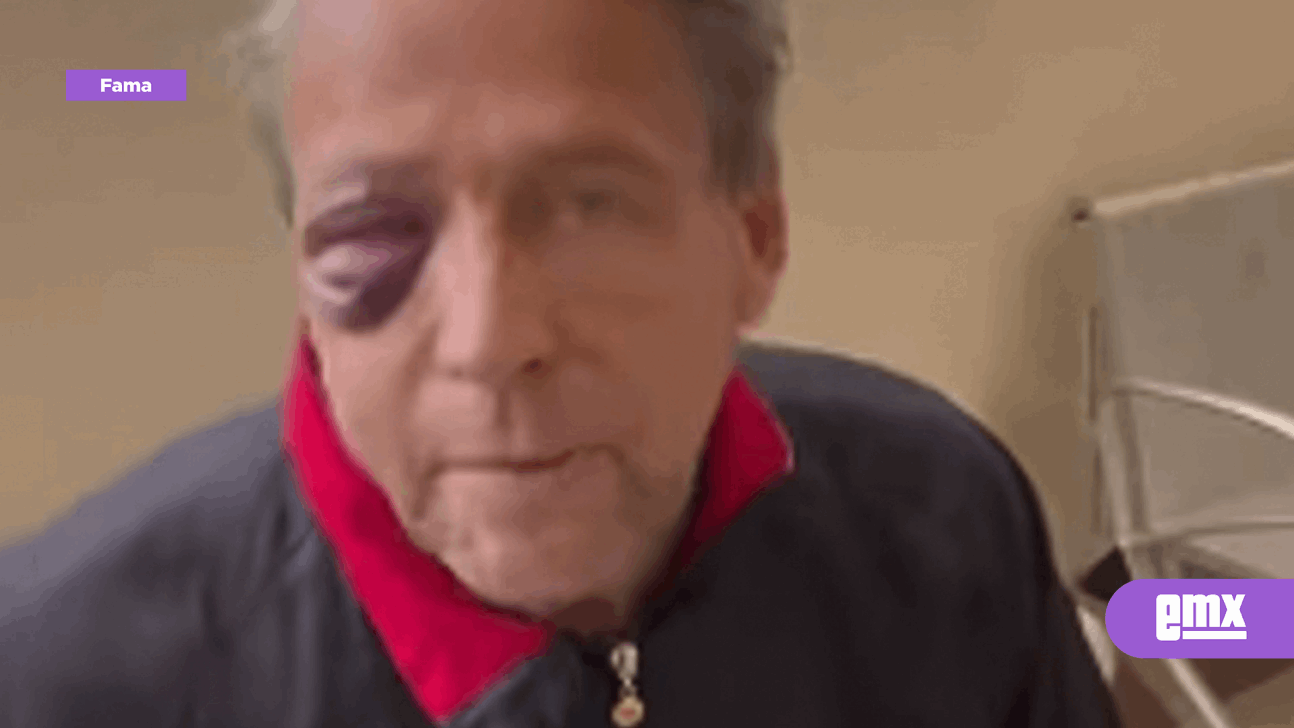 EMX-Alfredo Adame confirma que necesita cirugía por fracturas tras brutal golpiza