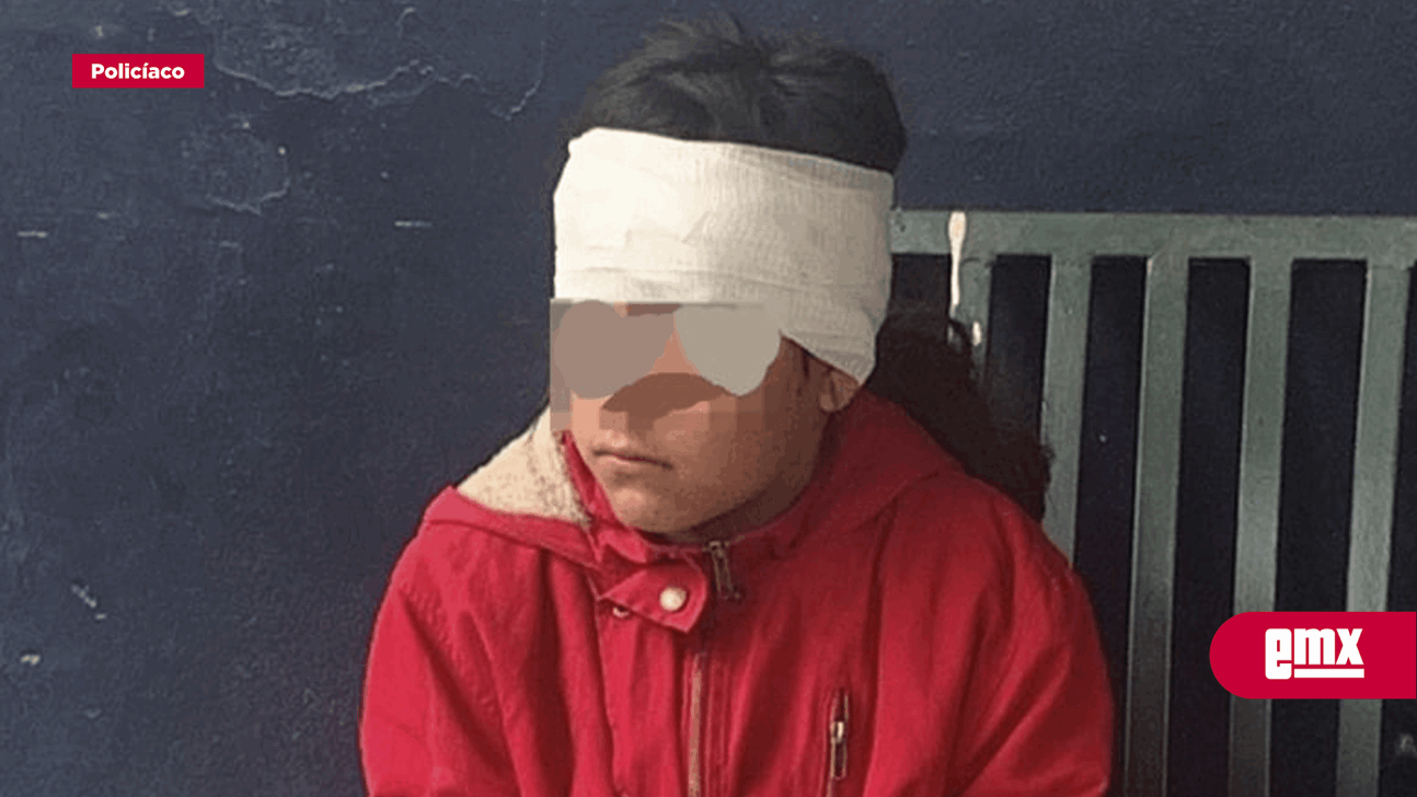 EMX-Abuelastra golpeó con un martillo a niña de 9 años