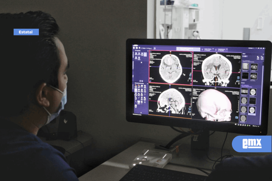 EMX-Concientiza HGM sobre síntomas y atención oportuna de los tumores cerebrales