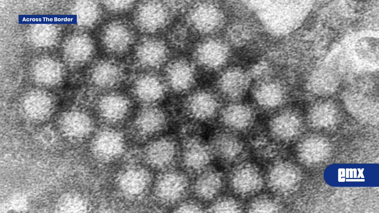 EMX-Qué-es-el-norovirus,-la-infección-que-enciende-las-alarmas-en-EU