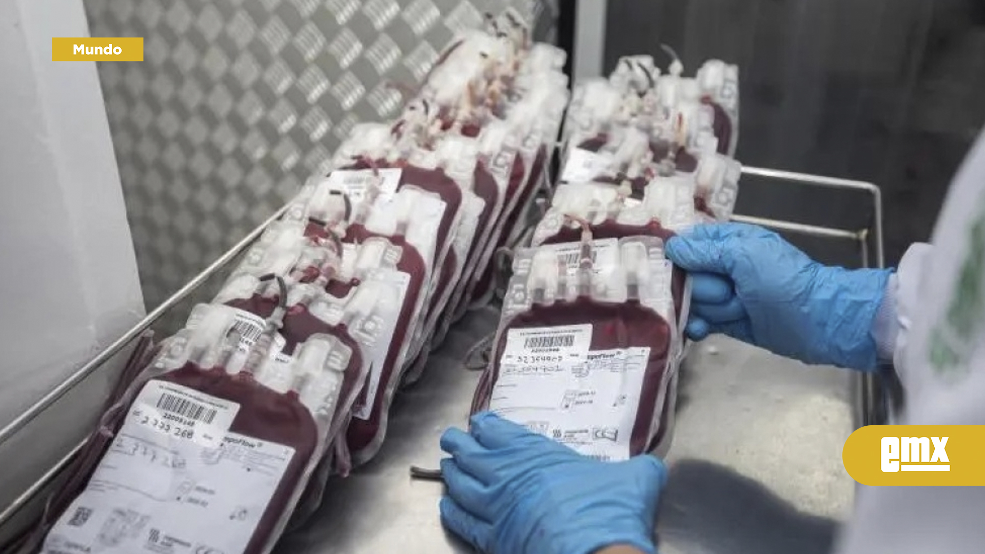 EMX-Hito-histórico-en-la-medicina:-científicos-japoneses-desarrollan-sangre-artificial-compatible-con-todos-los-grupos-sanguíneos