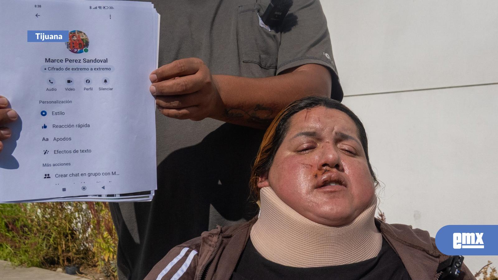 EMX-Familia-denuncia-a-Circo-de-los-Dinosaurios-tras-accidente-que-dejó-a-madre-en-silla-de-ruedas