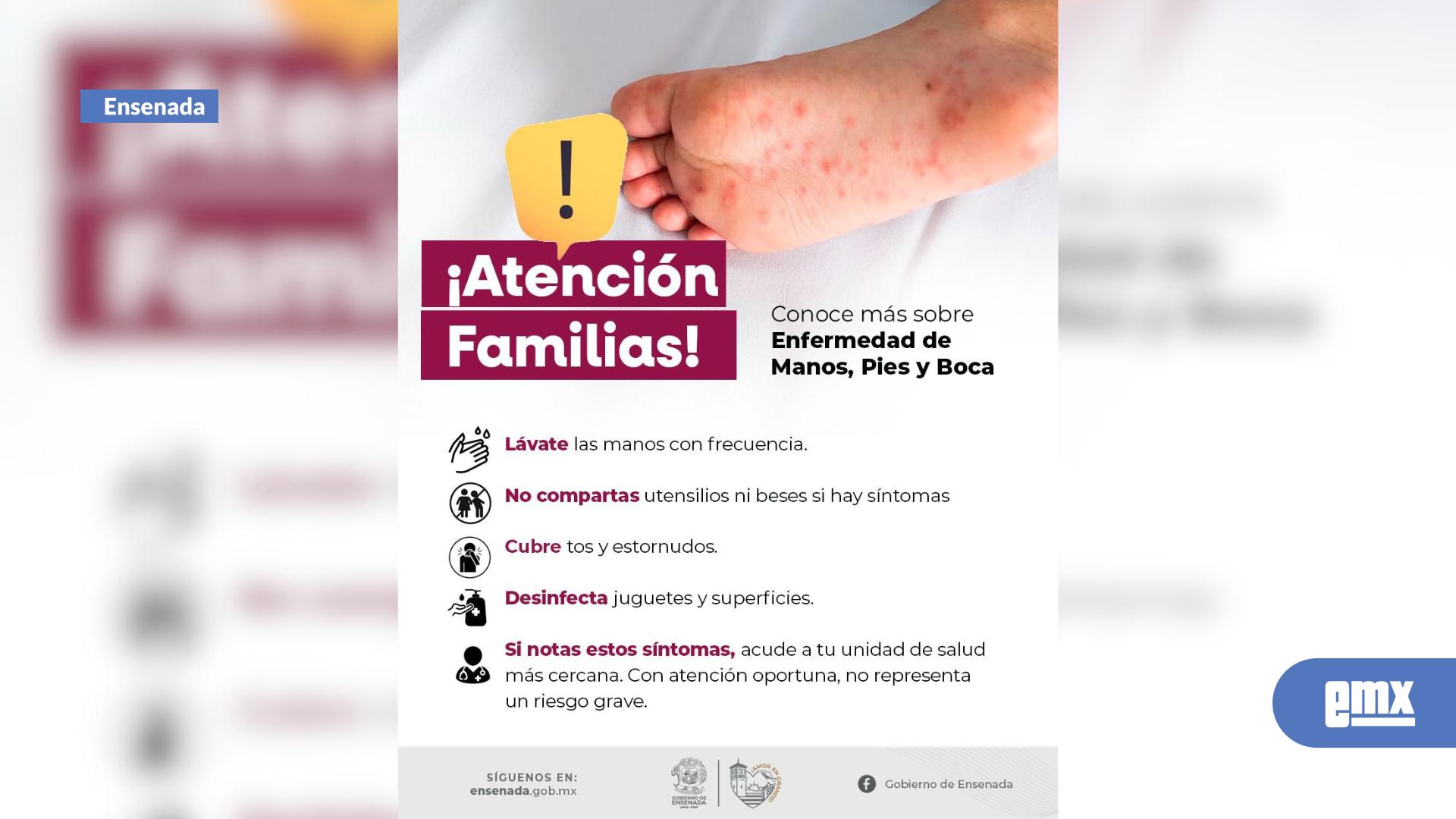 EMX-Llama-gobierno-de-Claudia-Agatón-a-prevenir-la-enfermedad-de-Manos,-Pies-y-Boca-(Virus-Coxsackie)