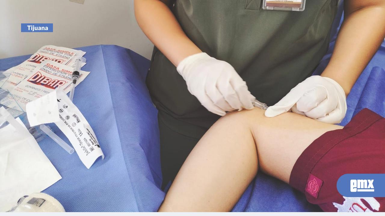 EMX-Promueven-implantes-anticonceptivos