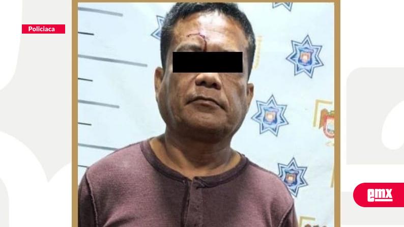 EMX-Con-ambos-puños,-el-"Pepe"-arremetió-a-golpes-contra-su-esposa