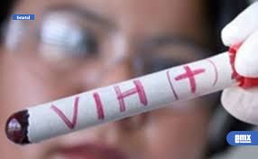 EMX-Baja California sube al 6.º lugar nacional en VIH por falta de detección