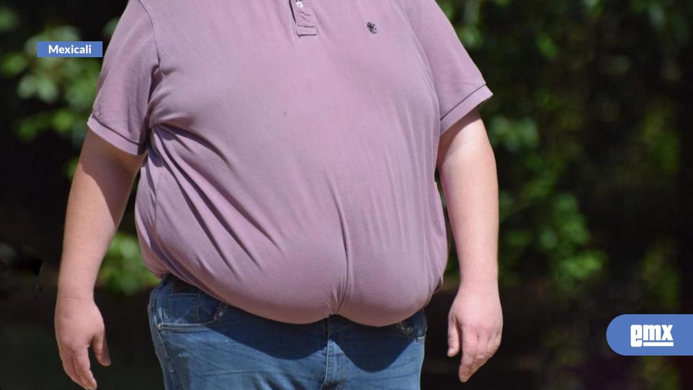 EMX-Propone-diputada-incorporación-de-cirugía-bariátrica-como-opción-en-instituciones-de-salud