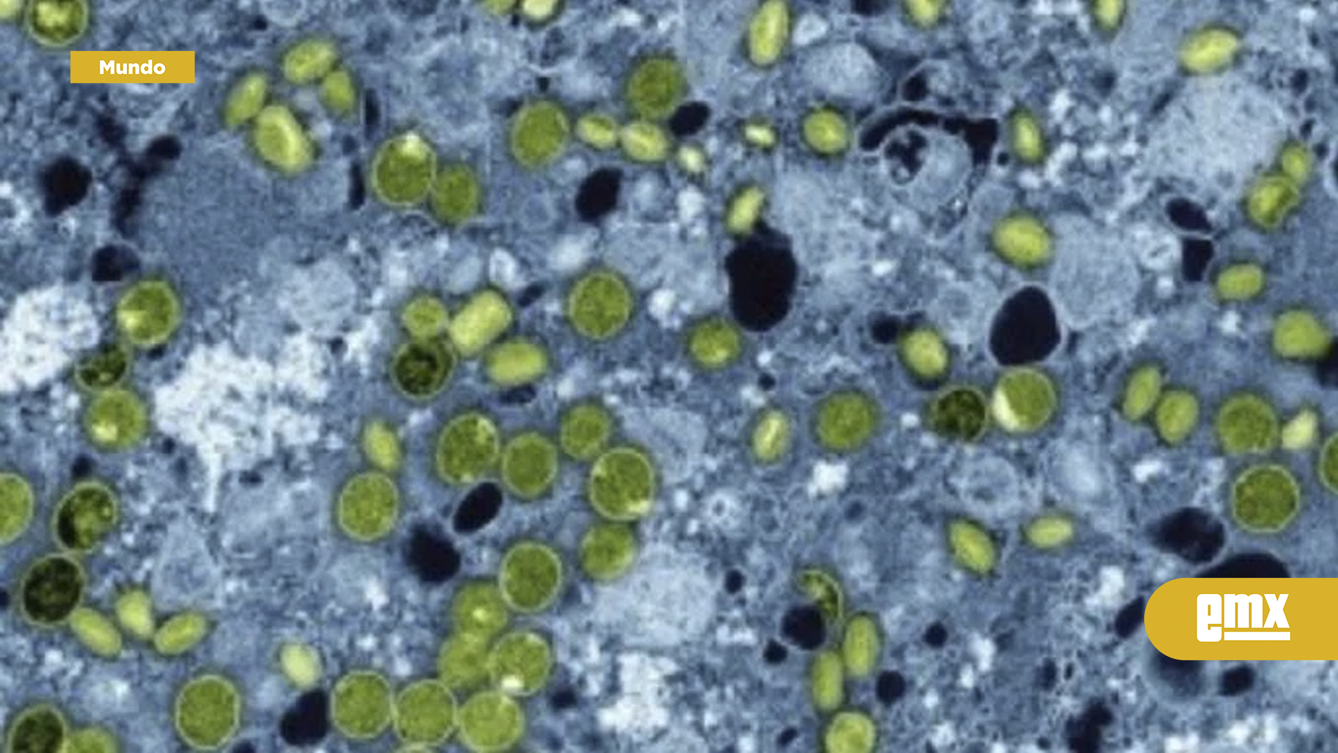 EMX-La-OMS-notifica-19-casos-y-cuatro-muertes-por-MERS-CoV-en-el-mundo-en-2025