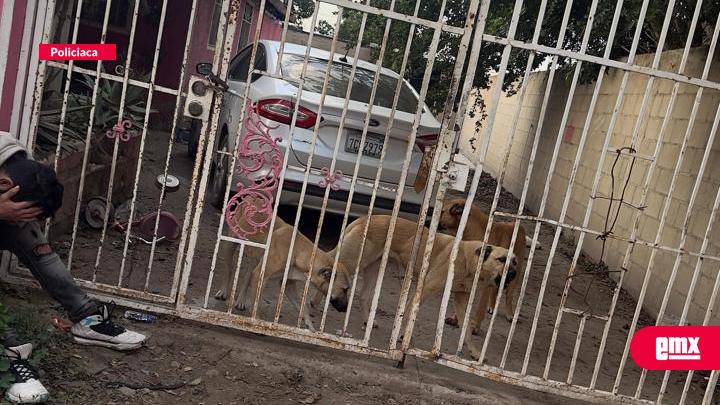 EMX-Grave;-continúa-el-niño-atacado-por-varios-perros-en-Tijuana