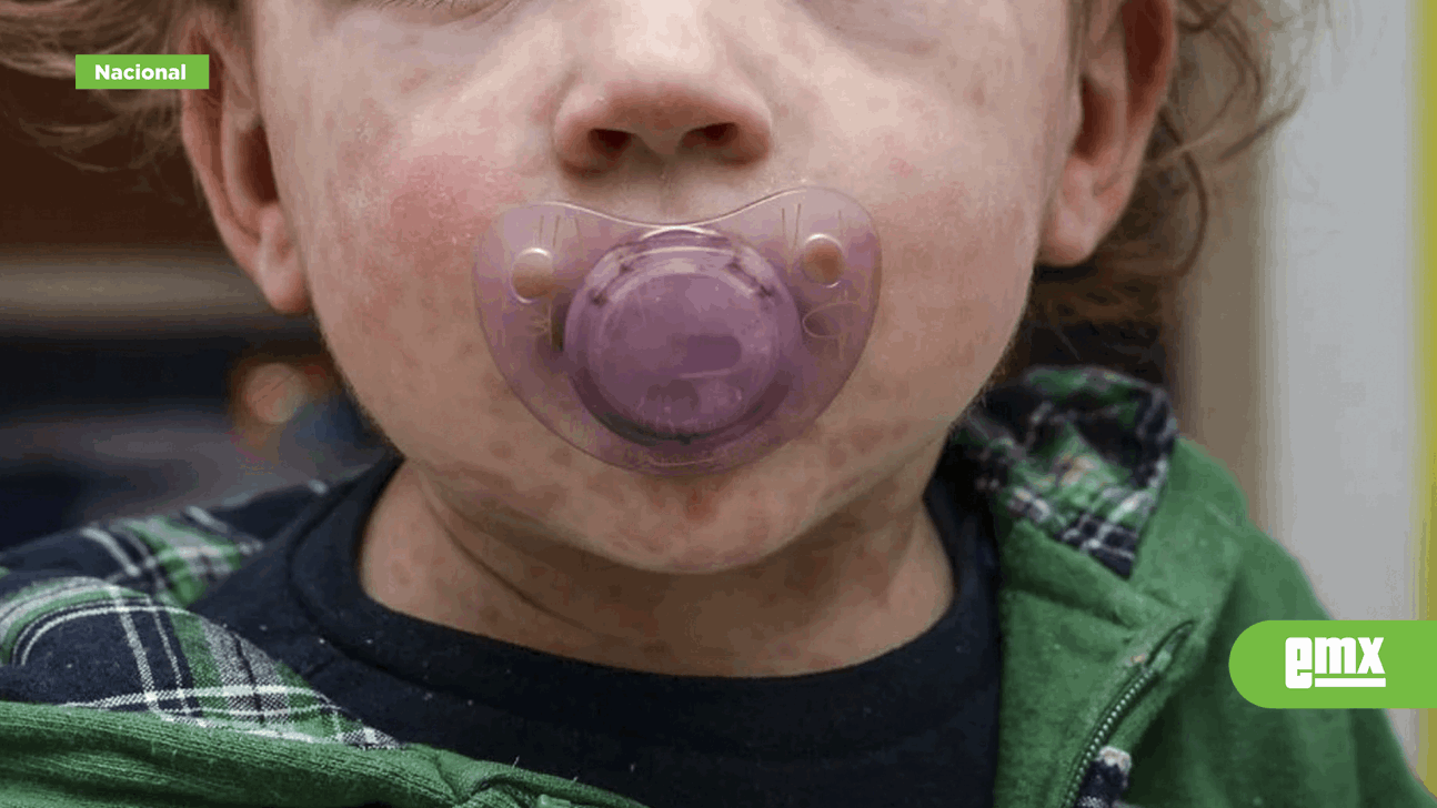 EMX-Muere-menor-de-2-años-en-Guerrero,-por-presunto-caso-de-sarampión