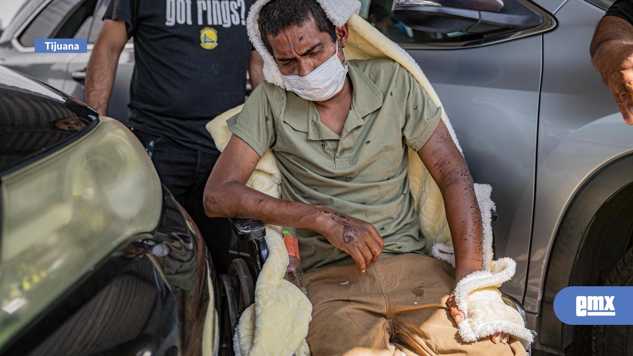 EMX-Migrante-es-víctima-de-violencia-extrema;-exigen-atención-urgente-y-asilo-político