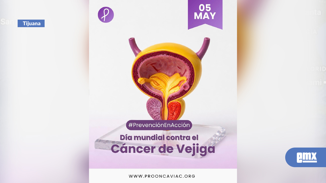 EMX-PRO-ONCAVI-llama-a-prevenir-el-cáncer-de-vejiga