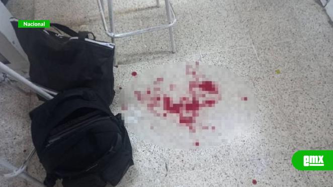 EMX-Alumno-apuñala-a-maestro-en-secundaria-de-Huimanguillo,-Tabasco;-lo-reportan-grave