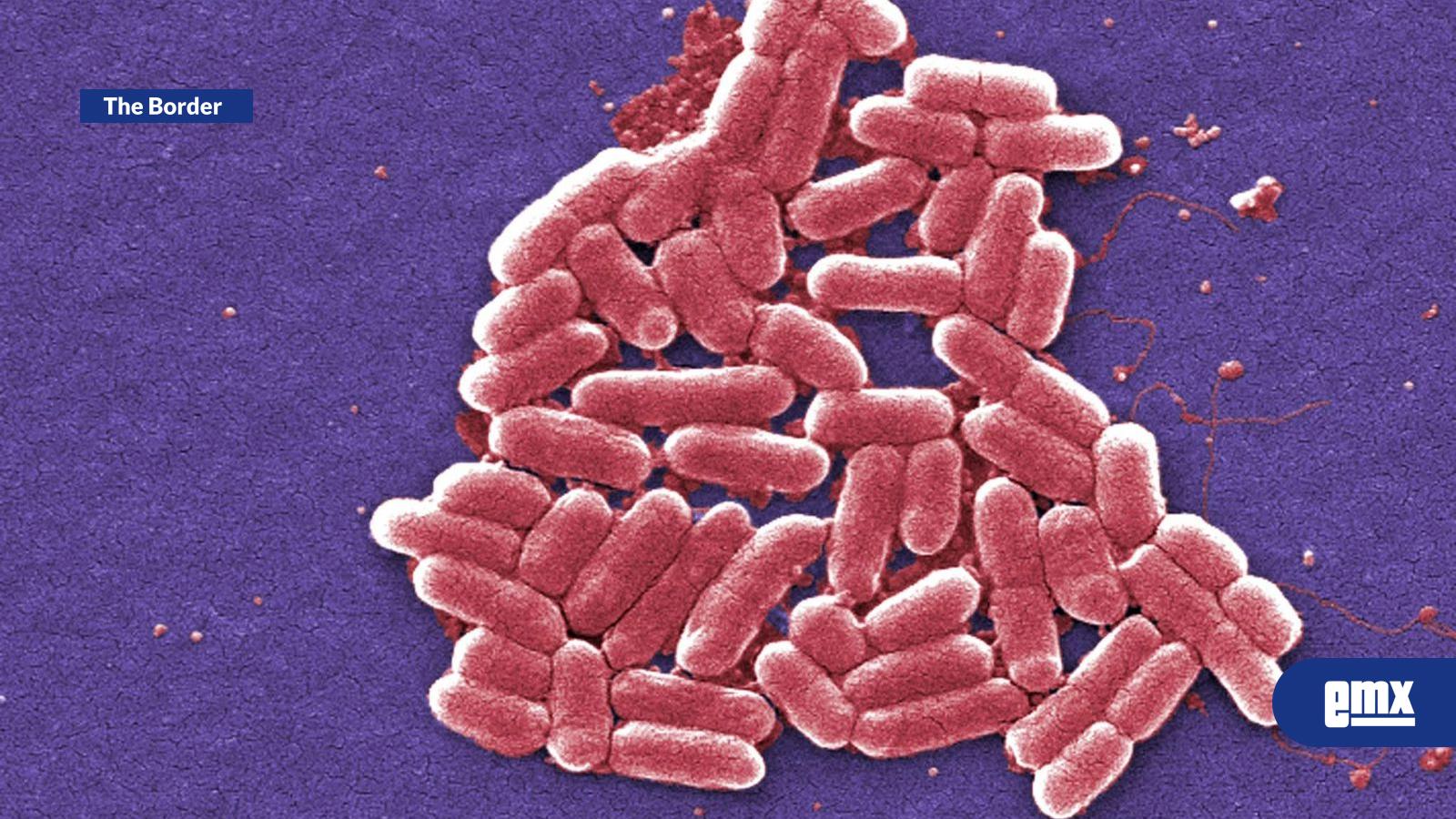 EMX-Registran-9-infectados-por-E.-Coli-por-comer-en-cadena-restaurantera-de-California