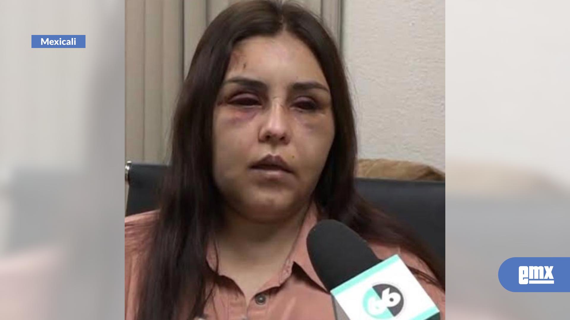 EMX-Vinculan-a-ex-pareja-por-tentativa-de-feminicidio