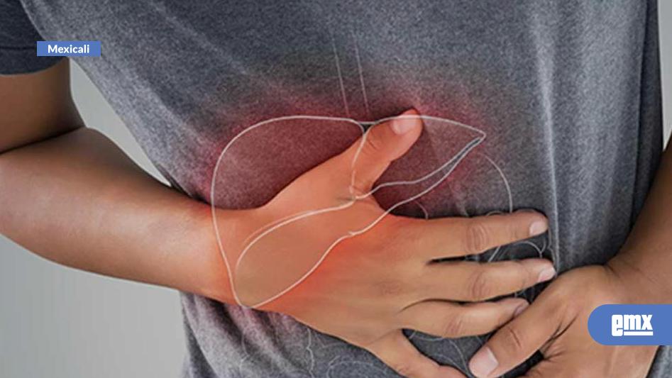 EMX-Realizan 60 tamizajes contra hepatitis 