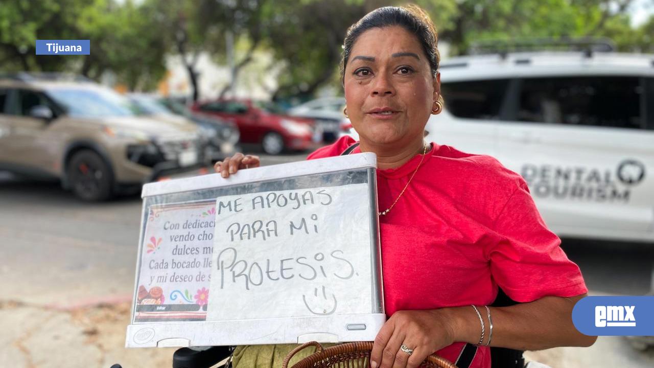 EMX-Lupita-busca-apoyo-para-conseguir-una-prótesis-y-recuperar-su-movilidad