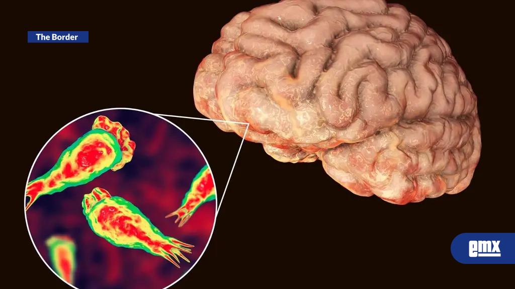 EMX-Muere-niña-de-8-años-por-ameba-“comecerebro”-en-EU